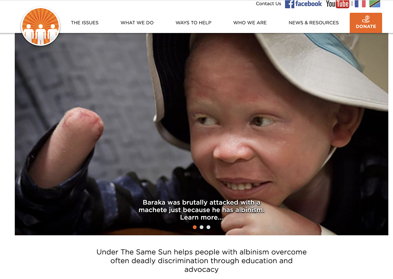 StS Episode 197: Albinism Advocacy: Under the Same Sun with Peter Ash-A